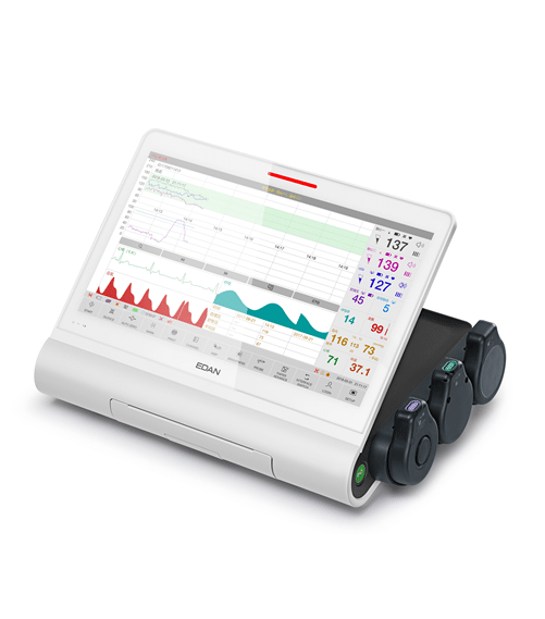 Monitor Fetal